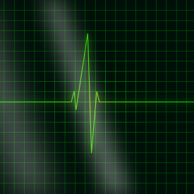a green electrocardiogram